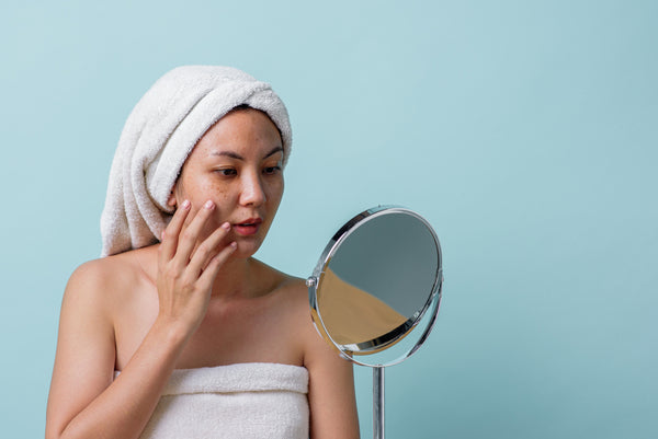Hyperpigmentation: What is It and How to Treat It