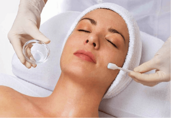 What are Chemical Peels?